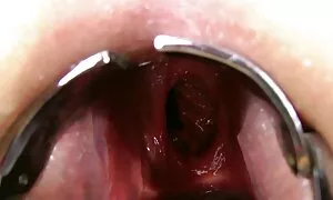 double anal fisting, ...